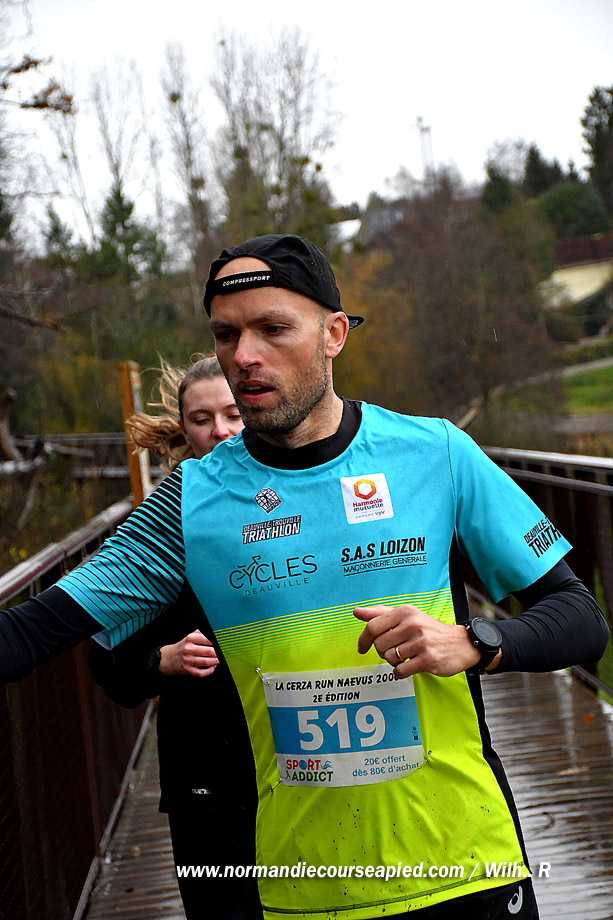 Cerza Run Naevus